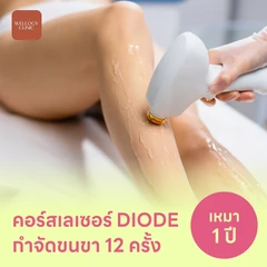 คอร์สเลเซอร์กำจัดขนทั่วขา 12 ครั้ง ด้วย Diode Laser