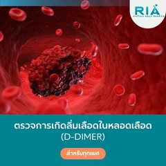 ตรวจการเกิดลิ่มเลือดในหลอดเลือด (D-Dimer) (เจาะเลือด)