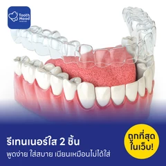 ทำรีเทนเนอร์แบบใส 2 ชิ้น