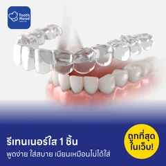 ทำรีเทนเนอร์แบบใส 1 ชิ้น