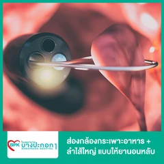 ส่องกล้องกระเพาะอาหาร + ลำไส้ใหญ่ แบบให้ยานอนหลับ