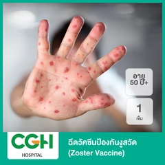 ฉีดวัคซีนป้องกันงูสวัด (Zoster Vaccine) 1 เข็ม (50 ปีขึ้นไป)