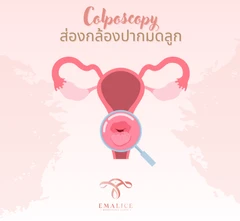 ส่องกล้องตรวจปากมดลูก