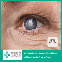 ผ่าตัดต้อกระจกแบบไร้ใบมีด + เปลี่ยนเลนส์แก้วตาเทียมหลายระยะ เกรดพรีเมียม 1 ข้าง (60 ปีขึ้นไป)