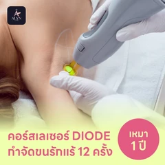 คอร์สเลเซอร์กำจัดขนรักแร้ 12 ครั้ง ด้วย Diode Laser