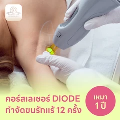 คอร์สเลเซอร์กำจัดขนรักแร้ 12 ครั้ง ด้วย Diode Laser