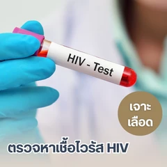 ตรวจหาเชื้อไวรัส HIV (เจาะเลือด)