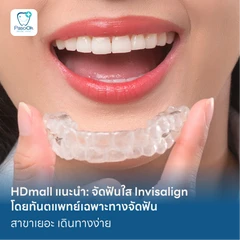 HDmall แนะนำ : จัดฟันใส Invisalign ดูแลโดยทันตแพทย์เฉพาะทางด้านจัดฟัน สาขาเยอะ เดินทางง่าย