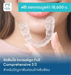 จัดฟันใส Invisalign Full Comprehensive 3 ปี