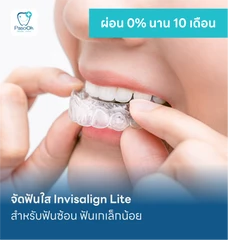 จัดฟันใส Invisalign Lite