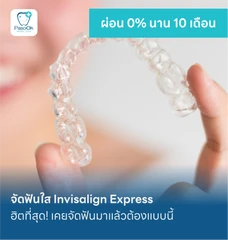 จัดฟันใส Invisalign Express