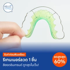 ทำรีเทนเนอร์แบบลวด 1 ชิ้น