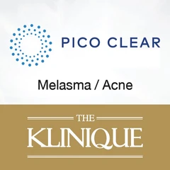 เลเซอร์รักษาหลุมสิว ด้วย PICO Clear Enlighten FX บริเวณใบหน้า 1 ครั้ง