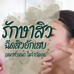 ฉีดสิวอักเสบไม่จำกัดเม็ด ทั่วใบหน้า