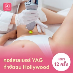 คอร์สเลเซอร์กำจัดขนน้องสาวแบบ Hollywood (vVIO) 12 ครั้ง ด้วย YAG Laser