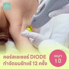 คอร์สเลเซอร์กำจัดขนรักแร้ 12 ครั้ง ด้วย Diode Laser