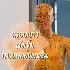 ฝังเข็ม + ครอบแก้ว คลายจุดกล้ามเนื้อตามร่างกาย