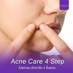 รักษาสิวหน้า (Acne Care 4 Step) 4 ขั้นตอน