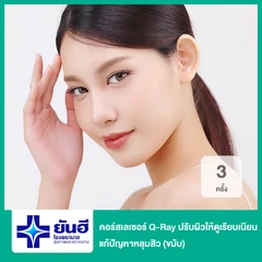 คอร์สเลเซอร์ Q-Ray ปรับผิวให้ดูเรียบเนียน แก้ปัญหาหลุมสิว 3 ครั้ง (ขมับ)