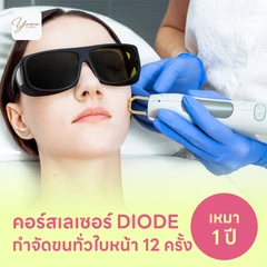 คอร์สเลเซอร์กำจัดขนทั่วหน้า 12 ครั้ง ด้วย Diode Laser