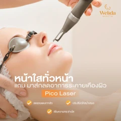 โปรแกรม Pico Laser หน้าใส ฟรี! มาส์กลดอาการระคายเคืองผิว