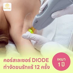 คอร์สเลเซอร์กำจัดขนรักแร้ 12 ครั้ง ด้วย Diode Laser (แพ็กเกจ HDmall+)