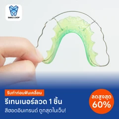 ทำรีเทนเนอร์แบบลวด 1 ชิ้น ฟันบนหรือล่าง