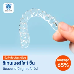 ทำรีเทนเนอร์แบบใส 1 ชิ้น