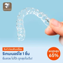 ทำรีเทนเนอร์แบบใส 1 ชิ้น