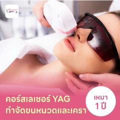 คอร์สเลเซอร์กำจัดขนหนวดและเครา 12 ครั้ง ด้วย YAG Laser