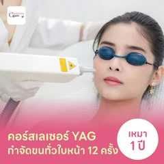 คอร์สเลเซอร์กำจัดขนทั่วหน้า 12 ครั้ง ด้วย YAG Laser