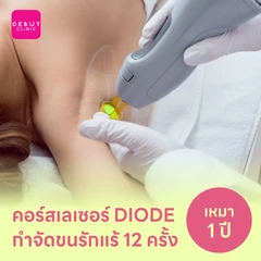 คอร์สเลเซอร์กำจัดขนรักแร้ 12 ครั้ง ด้วย Diode Laser
