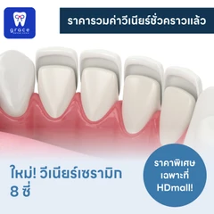 ทำวีเนียร์เซรามิก E-Max Press 8 ซี่