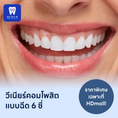 ทำวีเนียร์คอมโพสิตแบบฉีด 6 ซี่