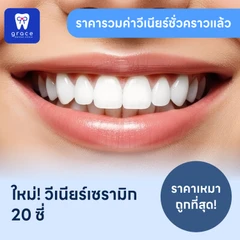 ทำวีเนียร์เซรามิก E-Max Press 20 ซี่