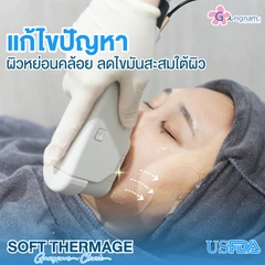 ทำ Soft Thermage Derwave จำกัดช็อตขึ้นอยู่กับแพทย์ประเมิน ทั่วใบหน้า 1 ครั้ง