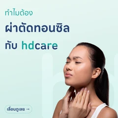 ผ่าตัดทอนซิล