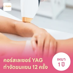 คอร์สเลเซอร์กำจัดขนแขน 12 ครั้ง ด้วย YAG Laser