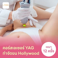 คอร์สเลเซอร์กำจัดขนน้องสาวแบบ Hollywood (vVIO) 12 ครั้ง ด้วย YAG Laser