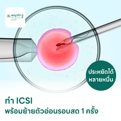 ทำ ICSI พร้อมย้ายตัวอ่อนรอบสด 1 ครั้ง