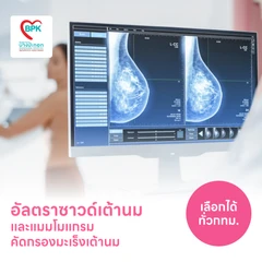 ตรวจคัดกรองมะเร็งเต้านมด้วยวิธีอัลตราซาวด์และแมมโมแกรม