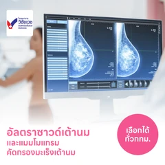 ตรวจคัดกรองมะเร็งเต้านมด้วยวิธีอัลตราซาวด์และแมมโมแกรม