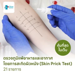 ตรวจหาสารก่อภูมิแพ้อาหารและสารก่อภูมิแพ้ในอากาศ 21 รายการ โดยการสะกิดผิวหนัง