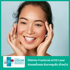 โปรแกรม Fractional eCO2 Laser ช่วยลดริ้วรอย รักษาหลุมสิว ลดรอยแผลเป็น (ทั่วหน้า)