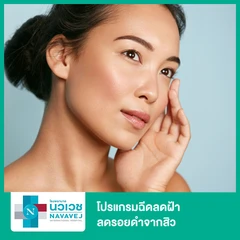 โปรแกรมฉีดลดฝ้า ลดรอยดำจากสิว