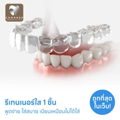 ทำรีเทนเนอร์แบบใส 1 ชิ้น