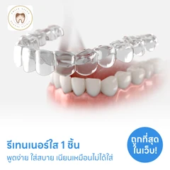 ทำรีเทนเนอร์แบบใส 1 ชิ้น