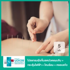 โปรแกรมฝังเข็มลดปวดแผนจีน + กระตุ้นไฟฟ้า + โคมร้อน + ครอบแก้ว 5 ครั้ง