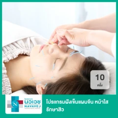 โปรแกรมฝังเข็มแผนจีน หน้าใส รักษาสิว 10 ครั้ง