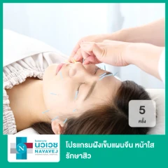 โปรแกรมฝังเข็มแผนจีน หน้าใส รักษาสิว 5 ครั้ง